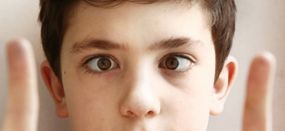 Amblyopia (Lazy Eye)